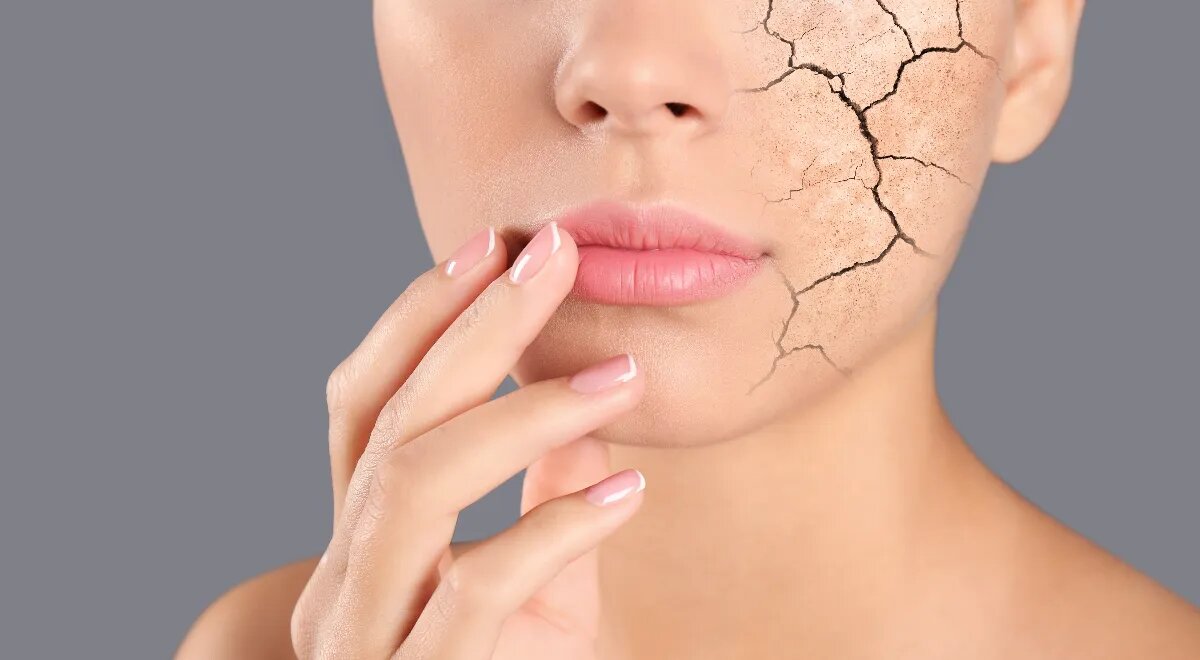 Как понять, что кожа нуждается в увлажнении
